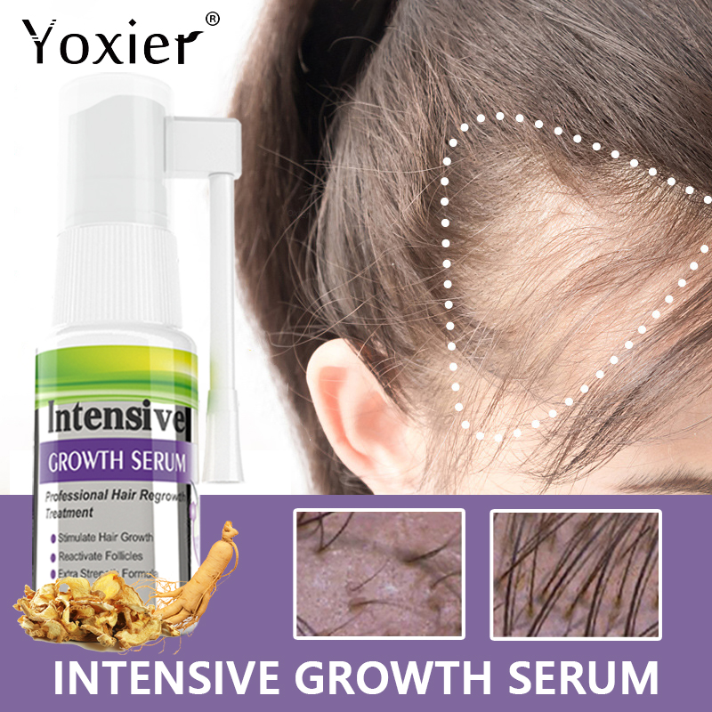 Hair Care Growth - 集中成長血清,脱毛防止,頭皮治療,再活性化,栄養補給,生姜ケア