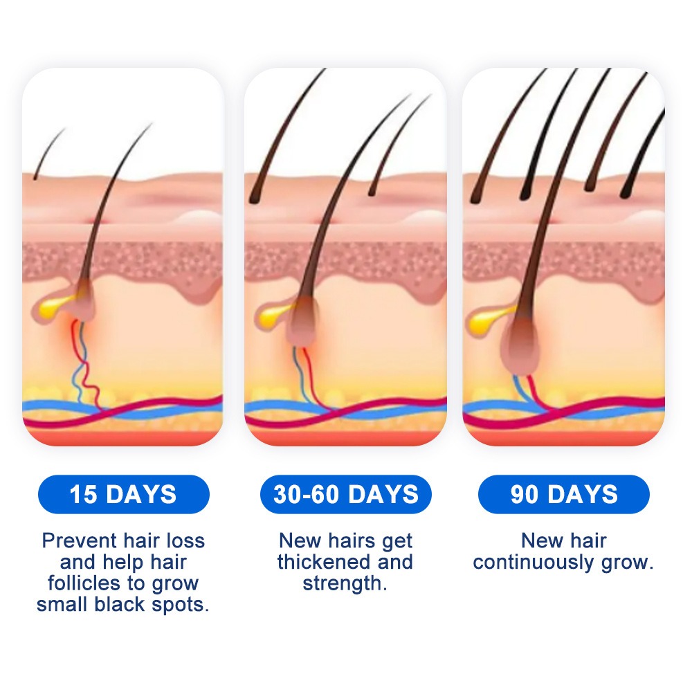 脱毛症育毛スプレー ソフォラ フラベセンス 脱毛症クリームス - Hair Care Growth のレビューと価格