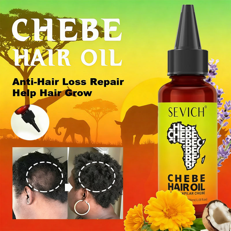 チェベ高速育毛オイル アフリカ 脱毛症 チェベオイル 栄養補 - Hair Care Essence Oil のレビューと価格