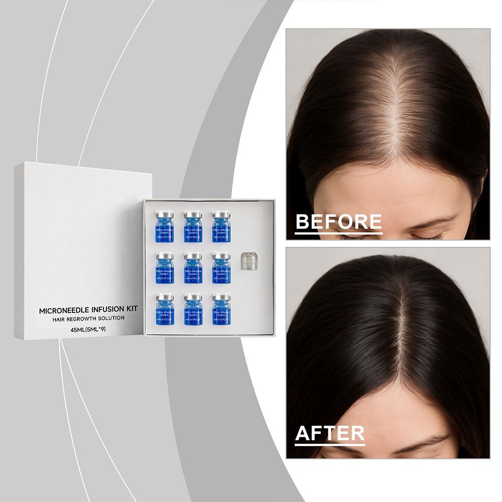 0.25 ミリメートルヘアエッセンシャルセラムマイクロニード - Hair Care Essence Oil のレビューと価格