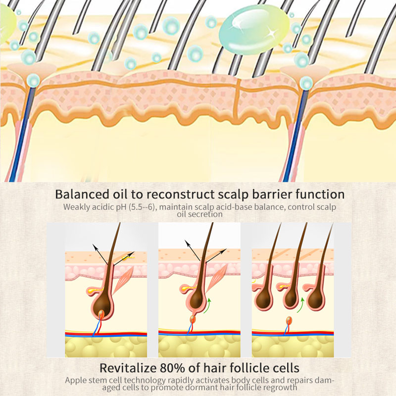 Sevich-髪の成長のためのオイルエッセンス,育毛の治療, - Hair Care Essence Oil のレビューと価格