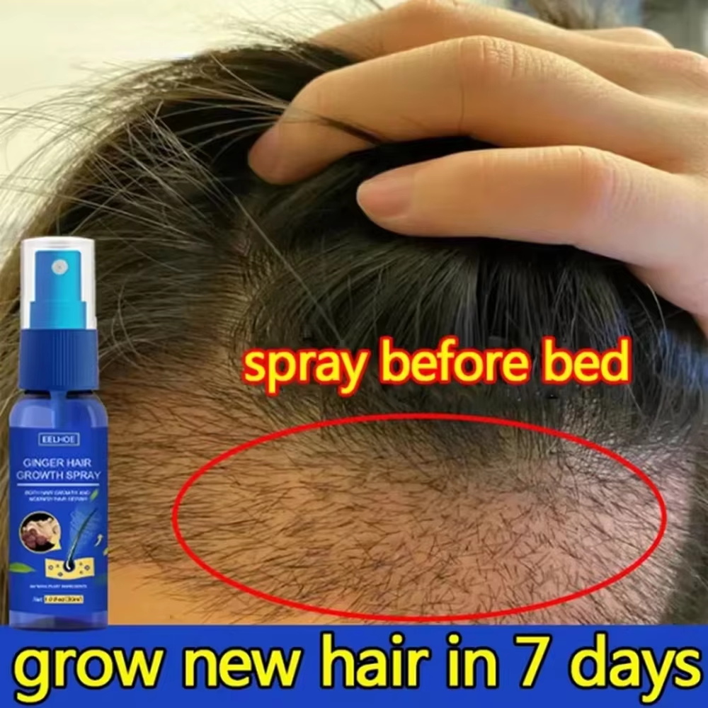 速効性ジンジャーヘアグローススプレー、毛根育成、脱毛防止、育 - Hair Care Growth のレビューと価格