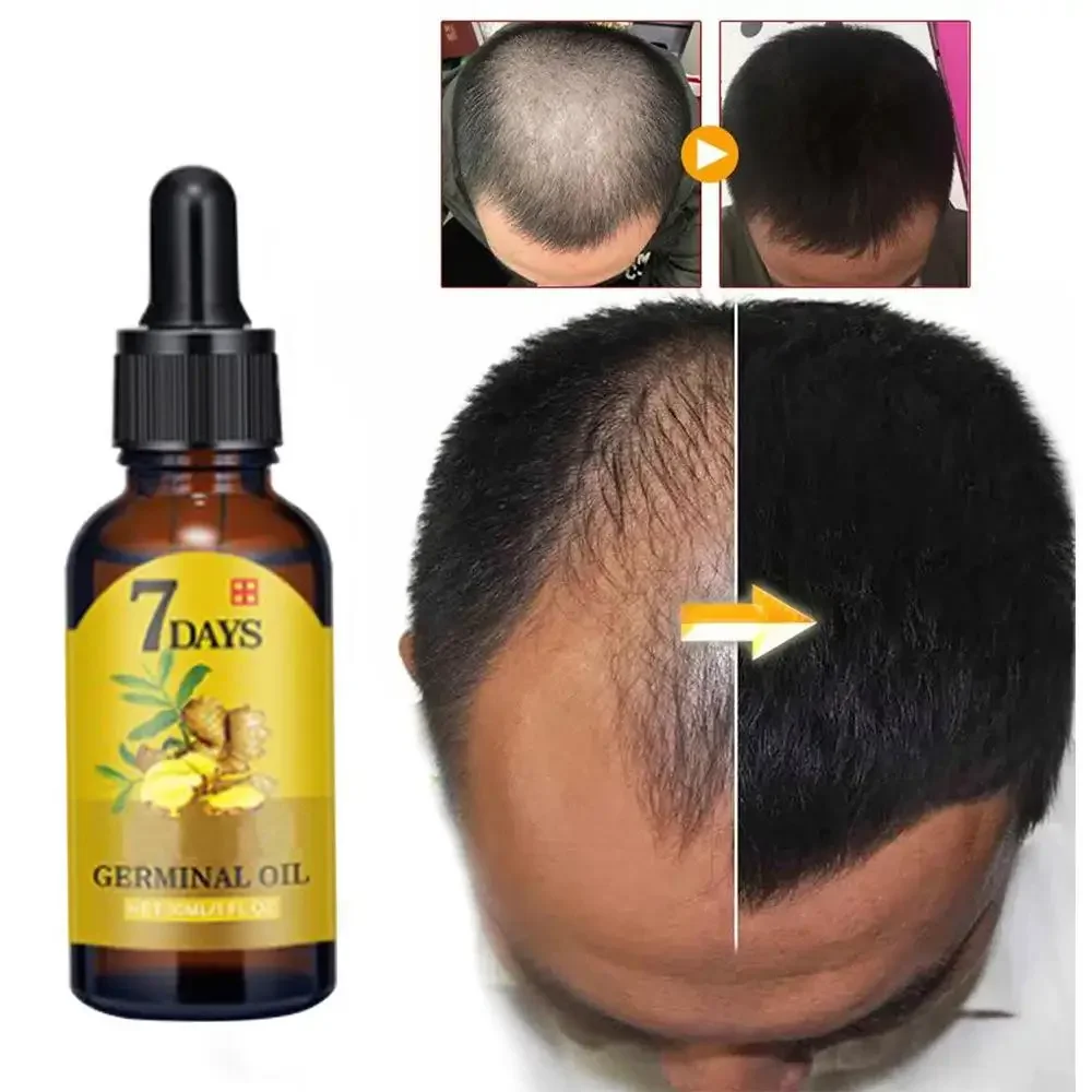 育毛ジンジャー高速成長髪エッセンシャルオイルヘアケア損失防止 - Hair Care Essence Oil のレビューと価格