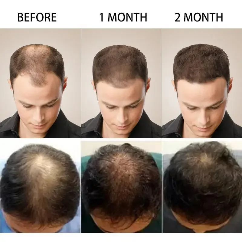 育毛ジンジャー高速成長髪エッセンシャルオイルヘアケア損失防止 - Hair Care Essence Oil のレビューと価格