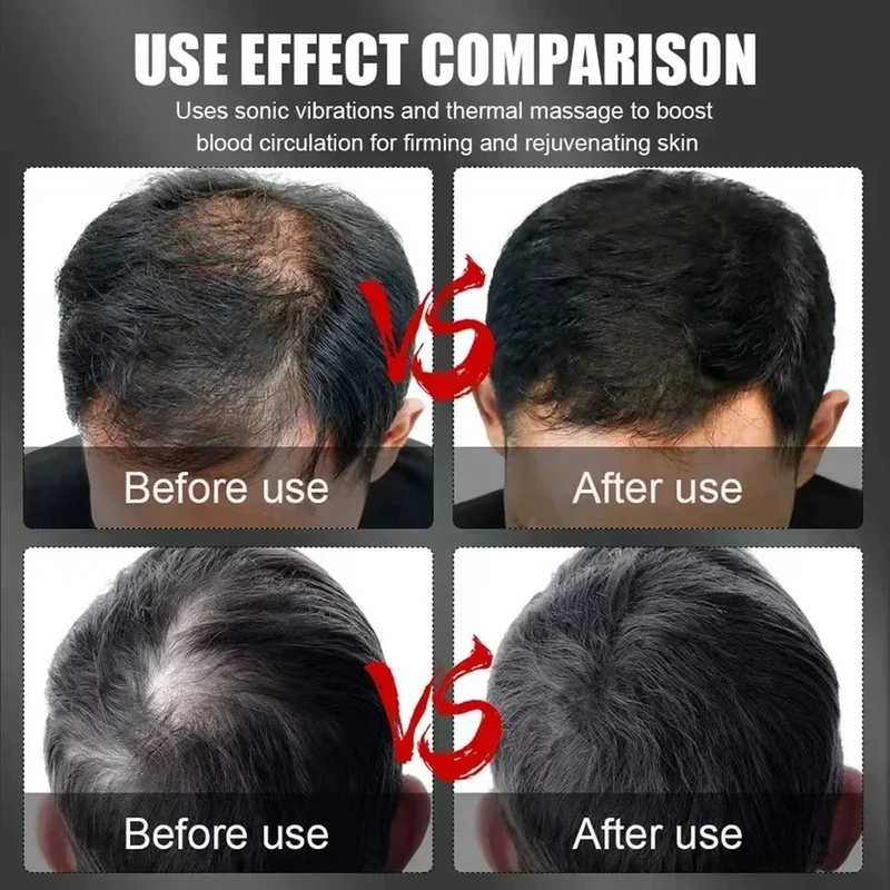 660nm 850nm赤色光赤外線ヘアセラピー育毛キャップ脱 - Hair Care Growth のレビューと価格